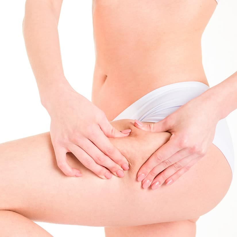 Trucs et conseils pour atténuer la cellulite