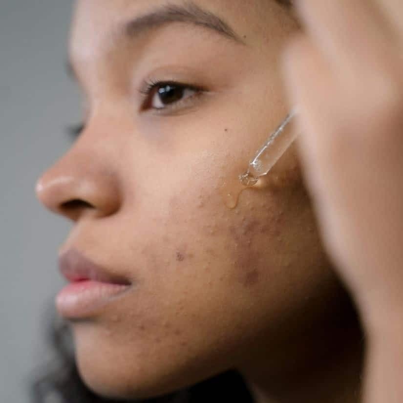 Top produits rétinol anti-âge