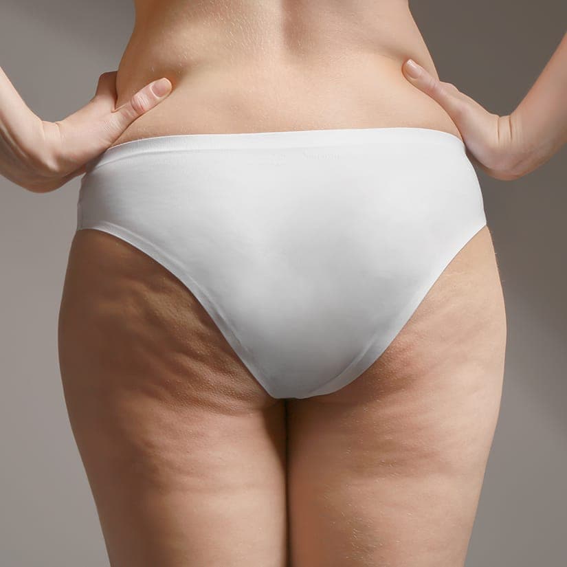 7 femmes fières de leur cellulite sur Instagram