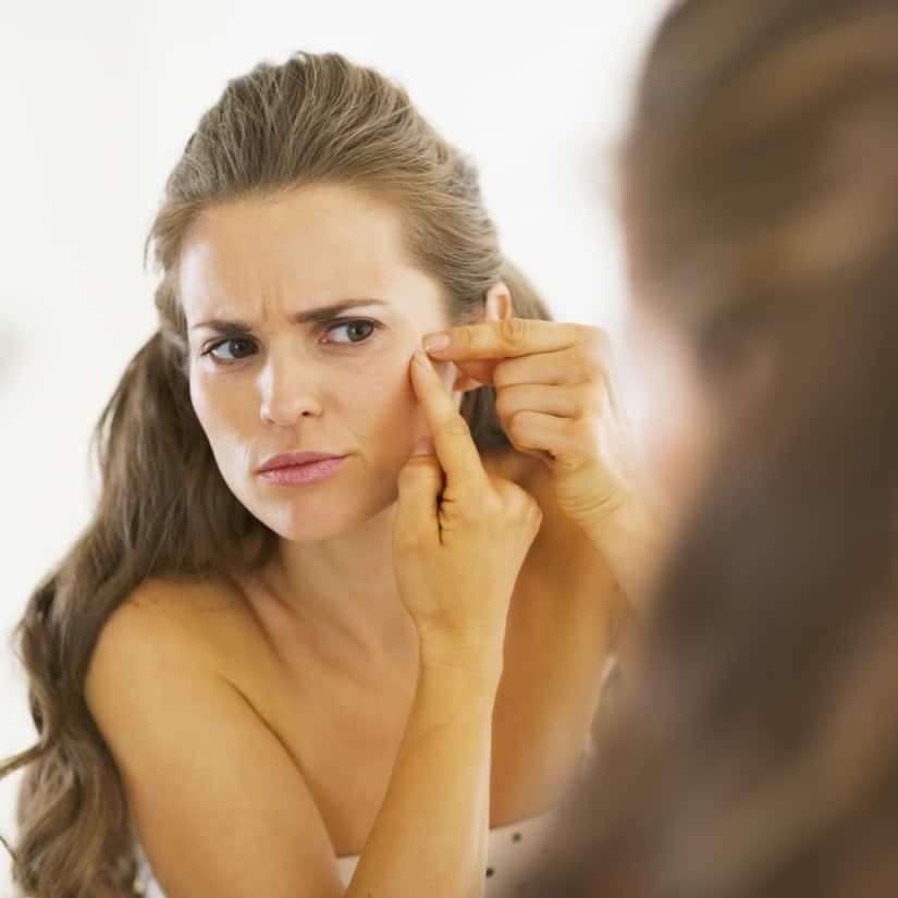 L'acné adulte : causes et solutions