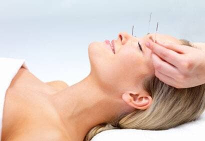 Les bienfaits de l'acupuncture